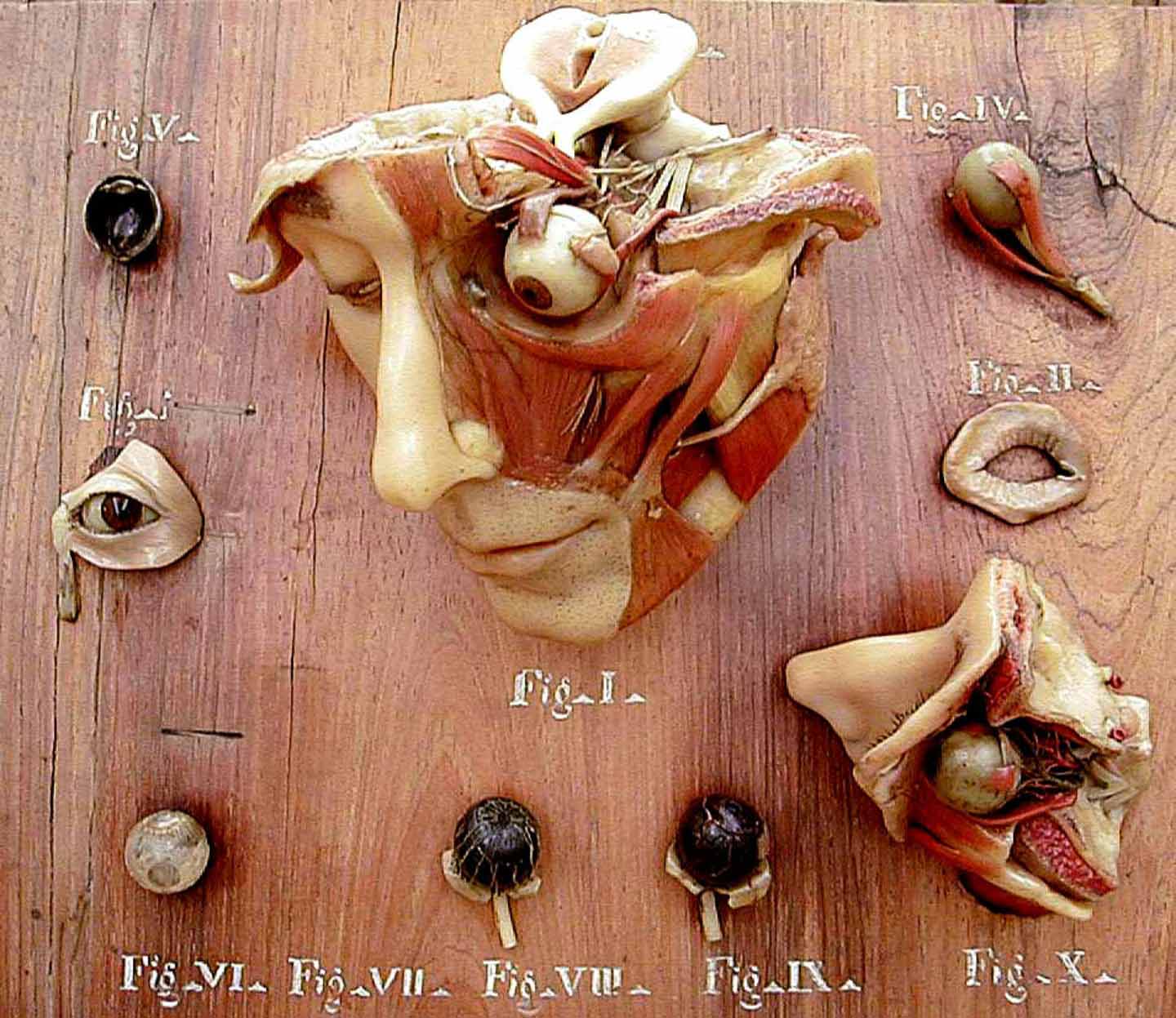 Collezione delle Cere Anatomiche "Luigi Cattaneo"